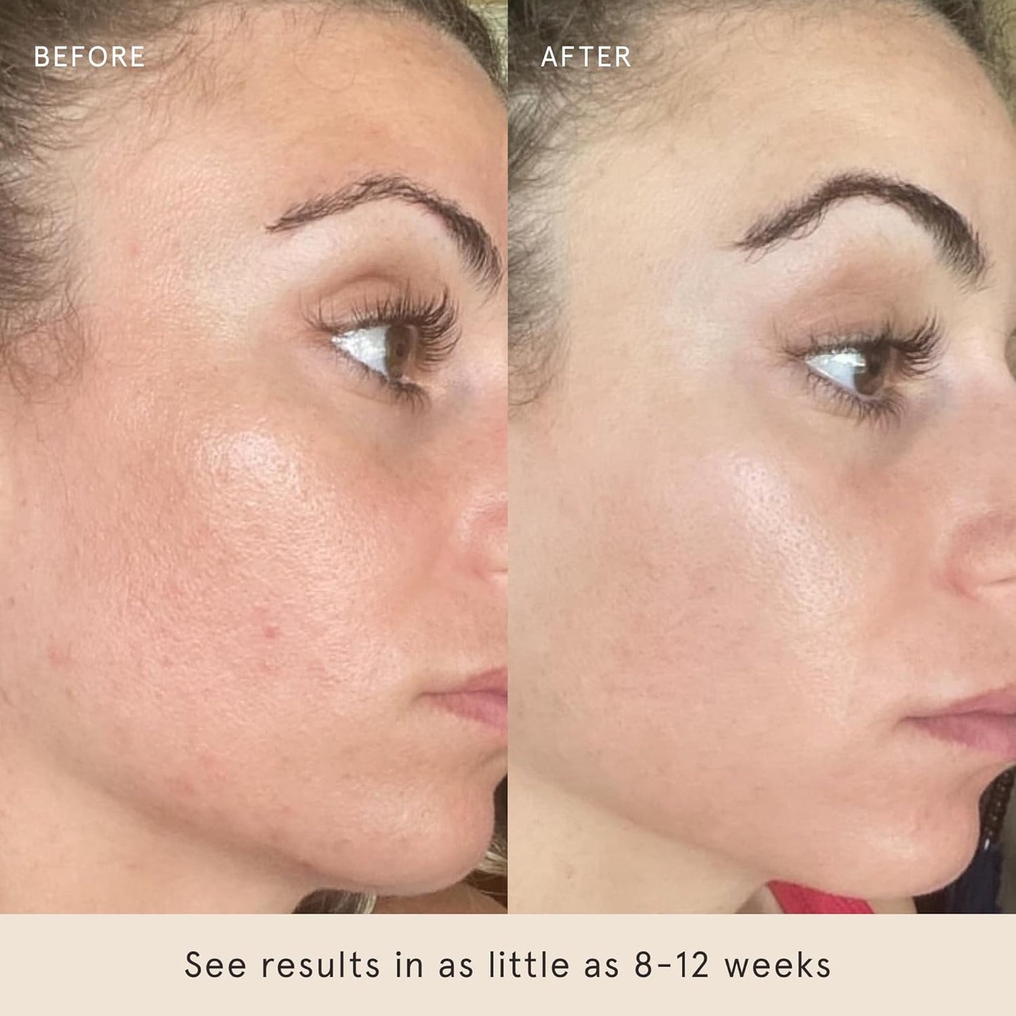 Liquid Gold 1 Fl Oz - 15% Vitamin C Serum with Hyaluronic Acid & Vitamin E for Anti-Aging, and Hydration, Antioxidant Formula, Reduces Dark Spots, Acne & Wrinkles