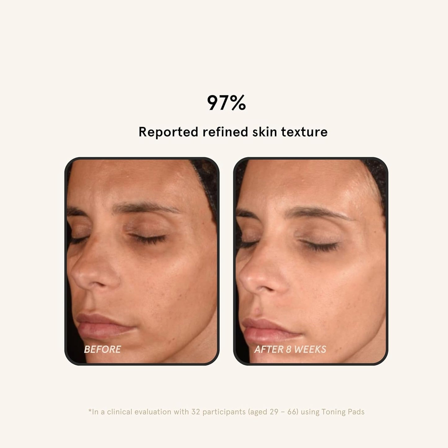 Toning Pads (60 Count) - Exfoliating Face Pads with 2% Glycolic Acid & Salicylic Acid - Brightens & Cleanses Skin, Clears Pores, Reduces Fine Lines & Wrinkles